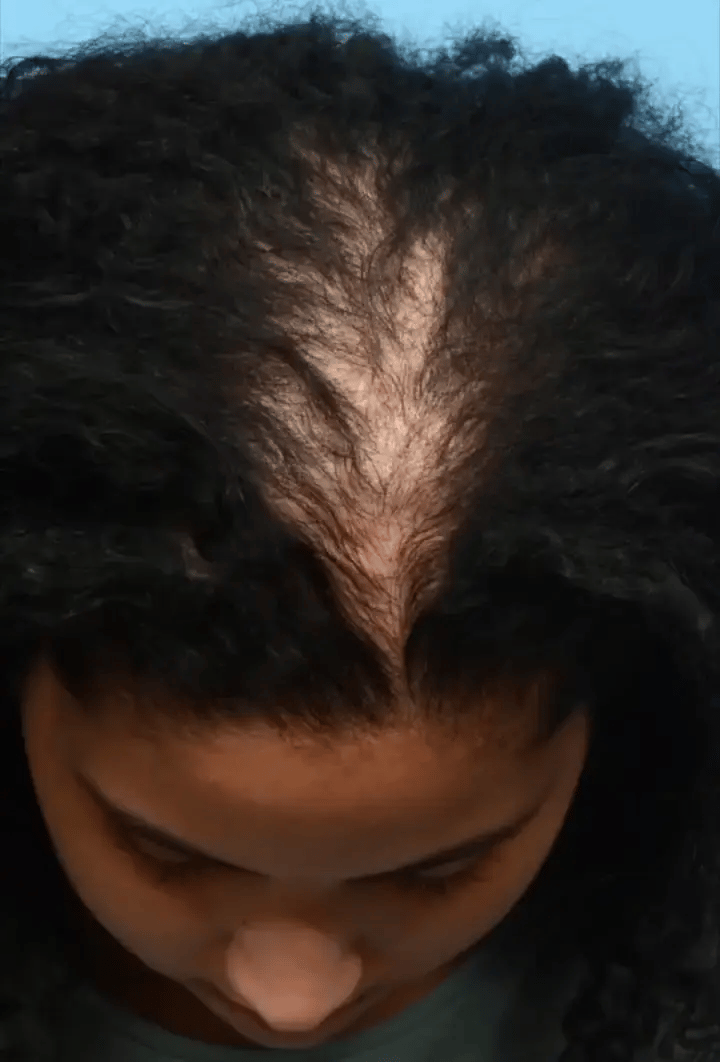 Hair transformation result